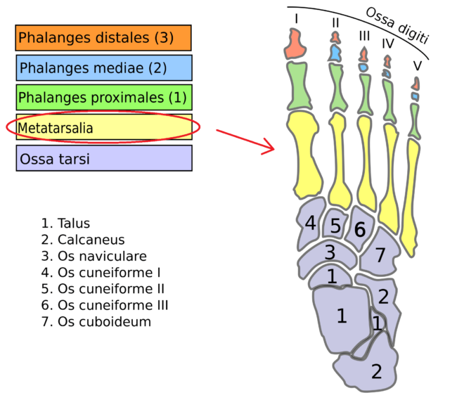 metatarsalgia